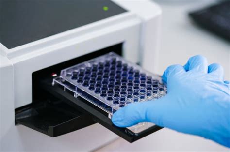 elisa test video|elisa diagnostic test.